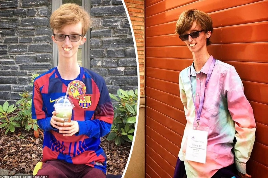 Căn bệnh khiến cậu thanh niên gầy guộc vì cơ thể không thể... tích mỡ